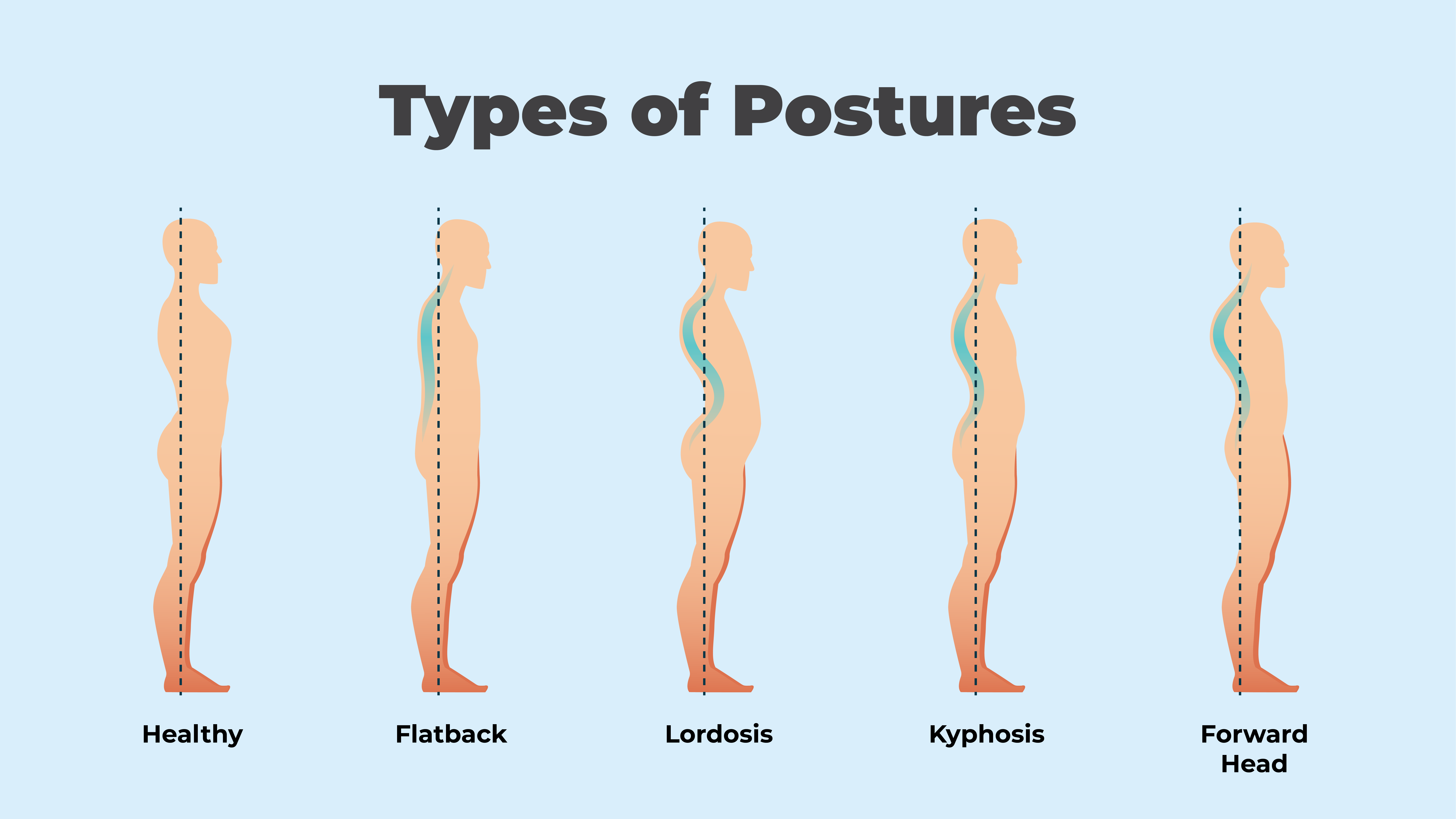 posture problems